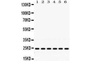 Western Blotting (WB) image for anti-RAB5A, Member RAS Oncogene Family (RAB5A) (AA 179-215), (C-Term) antibody (ABIN3043917) (RAB5 antibody  (C-Term))