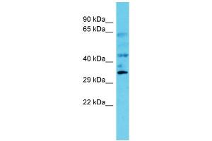 Host: Rabbit Target Name: C6orf106 Sample Type: Fetal Kidney lysates Antibody Dilution: 1. (C6orf106 antibody  (C-Term))