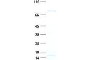 Validation with Western Blot (TNXB Protein (His tag))