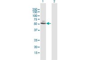 Western Blot analysis of PARP15 expression in transfected 293T cell line by PARP15 MaxPab polyclonal antibody. (PARP15 antibody  (AA 1-444))