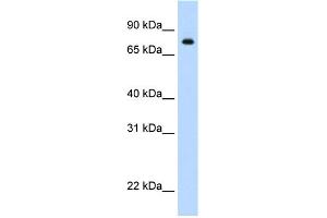 Western Blotting (WB) image for anti-Signal Transducer and Activator of Transcription 1, 91kDa (STAT1) (N-Term) antibody (ABIN2780843)