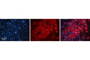 Rabbit Anti-SEPT-9 Antibody Catalog Number: ARP51756_P050 Formalin Fixed Paraffin Embedded Tissue: Human heart Tissue Observed Staining: Cytoplasmic Primary Antibody Concentration: 1:100 Other Working Concentrations: N/A Secondary Antibody: Donkey anti-Rabbit-Cy3 Secondary Antibody Concentration: 1:200 Magnification: 20X Exposure Time: 0. (Septin 9 antibody  (Middle Region))