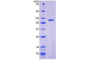 SDS-PAGE (SDS) image for Arachidonate 12-Lipoxygenase, 12R Type (ALOX12B) (AA 479-701) protein (His tag) (ABIN4989708)