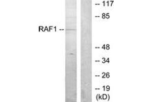 Western blot analysis of extracts from K562 cells, using C-RAF (Ab-259) Antibody. (RAF1 antibody  (AA 225-274))