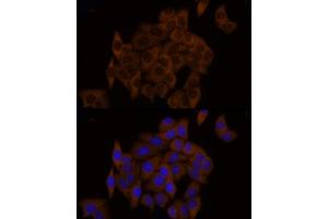 Immunofluorescence analysis of HeLa cells using GSDMD (Full Length+N terminal) Rabbit pAb (ABIN7267351) at dilution of 1:150 (40x lens). (GSDMD antibody  (AA 154-252))