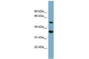 WB Suggested Anti-ADAMDEC1 Antibody Titration: 0. (ADAMDEC1 antibody  (Middle Region))