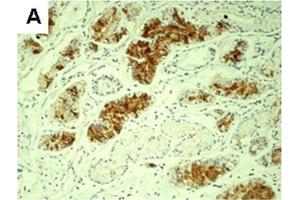 Expression of differentiated embryonic chondrocyte-expressed gene 1 (DEC1), hypoxia-inducible factor 1α (HIF-1α) and Ki67 protein in human gastric cancer tissue. (BHLHE40 antibody  (N-Term))