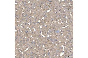 IHC analysis of SLC25A23 using anti-SLC25A23 antibody (ABIN7600165). (SLC25A23 antibody  (AA 16-189))