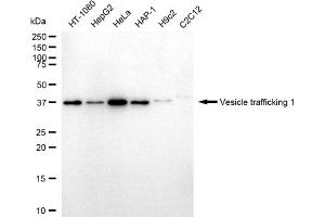 anti-Vps20-Associated 1 Homolog (VTA1) antibody
