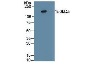 Detection of PTPRZ in Human Hela Cells using Polyclonal Antibody to Protein Tyrosine Phosphatase Receptor Type Z (PTPRZ) (Protein Tyrosine Phosphatase Receptor Type Z (AA 32-189) antibody)