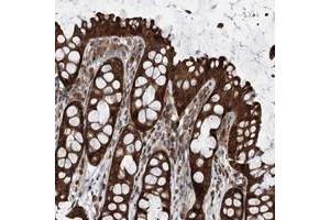 Immunohistochemical staining of human colon with VPS37B polyclonal antibody  shows strong cytoplasmic positivity in glandular cells. (VPS37B antibody)