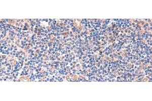 Immunohistochemistry of paraffin-embedded Human tonsil tissue using ZNF256 Polyclonal Antibody at dilution of 1:120(x200) (ZNF256 antibody)