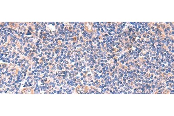 ZNF256 antibody