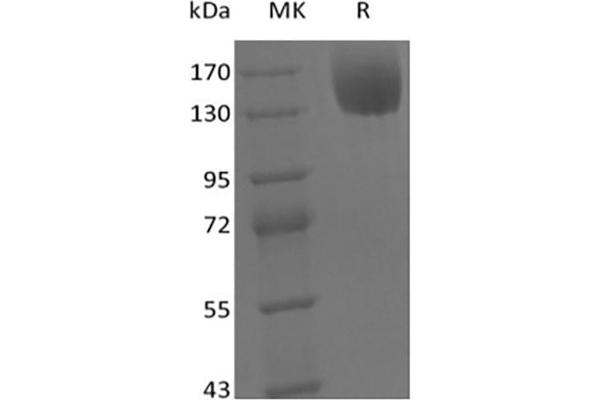 Leptin Receptor Protein (LEPR) (Fc Tag)