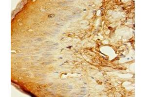 Immunohistochemistry of paraffin-embedded human skin tissue using ABIN7148341 at dilution of 1:100 (C1QTNF1 antibody  (AA 26-281))