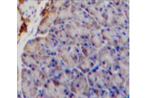 Used in DAB staining on fromalin fixed paraffin-embedded Pancreas tissue (IL9 Receptor antibody  (AA 47-257))