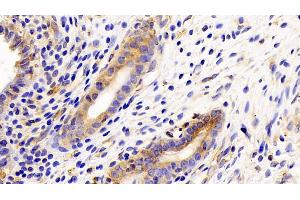 Detection of gp130 in Rat Uterus Tissue using Polyclonal Antibody to Glycoprotein 130 (gp130) (CD130/gp130 antibody  (AA 26-323))