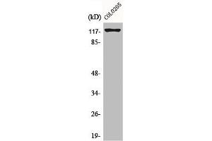 Western Blot analysis of COLO205 cells using Eg5 Polyclonal Antibody (KIF11 antibody)