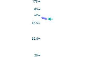 QDPR Protein (AA 1-244) (GST tag)
