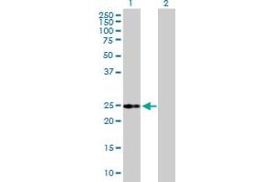 Western Blot analysis of IL6 expression in transfected 293T cell line by IL6 MaxPab polyclonal antibody. (IL-6 antibody  (AA 1-212))