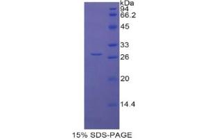 SDS-PAGE analysis of Rat LOXL1 Protein. (LOXL1 Protein)