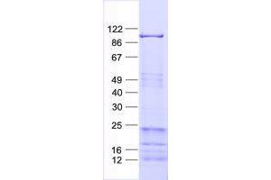 Validation with Western Blot (ZBTB24 Protein (His tag))
