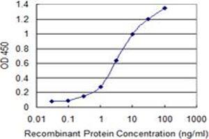 Detection limit for recombinant GST tagged SNCA is 0. (SNCA antibody  (AA 31-140))