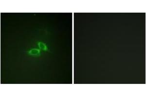 Immunofluorescence analysis of NIH-3T3 cells, using NMDAR1 (Ab-890) Antibody. (GRIN1/NMDAR1 antibody  (AA 856-905))