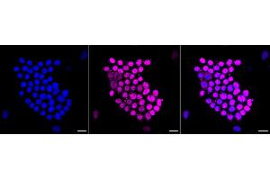 Immunocytochemical staining of Hela cells with DUT antibody (ABIN7798312), 1:1,000).
