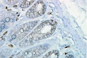 Immunohistochemistry (IHC) image for anti-Heat Shock Protein 90 (HSP90) antibody (ABIN361718)