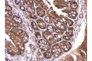 Immunohistochemistry (IHC) image for anti-14-3-3 zeta (YWHAZ) (Center) antibody (ABIN2854923)
