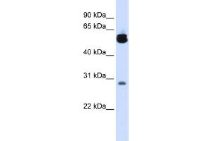WB Suggested Anti-YWHAZ Antibody Titration:  0. (14-3-3 zeta antibody  (Middle Region))