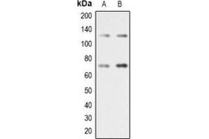 Western blot analysis of RAD21 expression in Jurkat (A), A431 (B) whole cell lysates. (RAD21 antibody  (C-Term))
