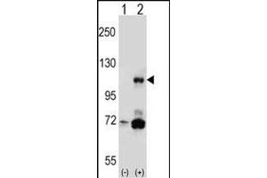 Western blot analysis of PIK3CB (arrow) using rabbit polyclonal PIK3CB Antibody (N-term ) (ABIN652426 and ABIN2842105). (PIK3CB antibody  (N-Term))