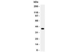 Western blot testing of Cathepsin G antibody and rat thymus lysate. (Cathepsin G antibody  (AA 76-255))