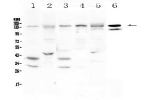 Western blot analysis of EPS15 using anti-EPS15 antibody . (EPS15 antibody  (AA 2-88))