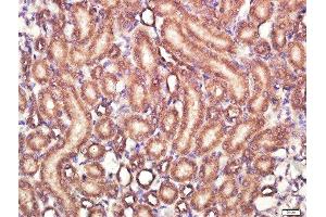 Paraformaldehyde-fixed, paraffin embedded rat kidney tissue, Antigen retrieval by boiling in sodium citrate buffer(pH6) for 15min, Block endogenous peroxidase by 3% hydrogen peroxide for 30 minutes, Blocking buffer (normal goat serum) at 37°C for 20min, Antibody incubation with IL-4I1 Polyclonal Antibody, Unconjugated  at 1:400 overnight at 4°C, followed by a conjugated secondary and DAB staining (IL4I1 antibody  (AA 51-160))