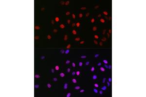 Immunofluorescence analysis of U2OS cells using Acetyl-Histone H3-K23 Rabbit mAb (ABIN3016647, ABIN3016648, ABIN3016649, ABIN1681125 and ABIN1681126) at dilution of 1:100 (40x lens). (Histone 3 antibody  (acLys23))