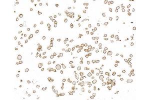 anti-Thrombomodulin (THBD) (AA 17-515) antibody