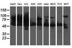 Image no. 2 for anti-Dihydrolipoamide Dehydrogenase (DLD) antibody (ABIN1497850) (DLD antibody)