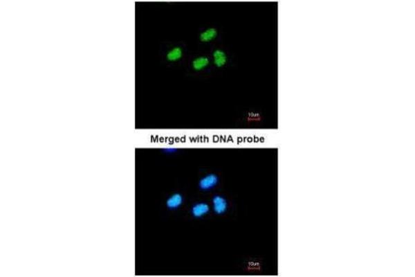 ATRX antibody  (C-Term)