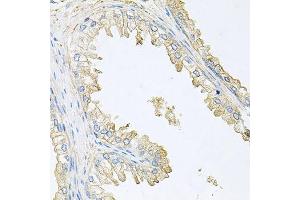 Immunohistochemistry of paraffin-embedded human prostate using PPP3R1 antibody. (PPP3R1 antibody  (AA 11-170))