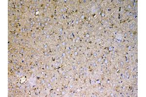 IHC analysis of Sacsin using anti-Sacsin antibody . (Sacsin antibody  (AA 3709-3909))