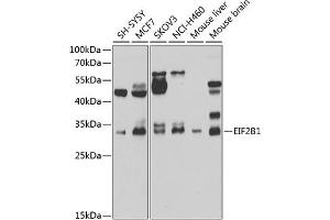 Western blot analysis of extracts of various cell lines, using EIF2B1 antibody (ABIN6132115, ABIN6140035, ABIN6140036 and ABIN6223878) at 1:1000 dilution. (EIF2B1 antibody  (AA 1-305))