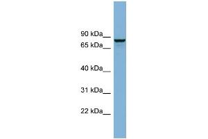WB Suggested Anti-GGA3 Antibody Titration: 0.