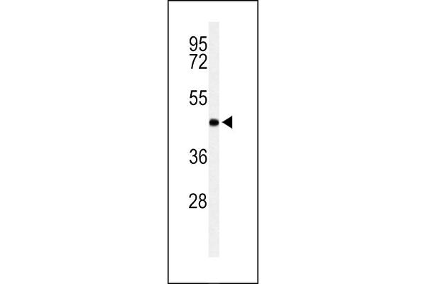 RPRD1B antibody  (C-Term)