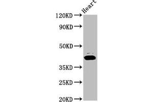 Western Blot Positive WB detected in: Rat heart tissue All lanes: NSDHL antibody at 7. (NSDHL antibody  (AA 154-211))