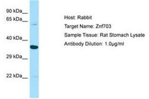 Image no. 1 for anti-Zinc Finger Protein 703 (ZNF703) (AA 513-562) antibody (ABIN6749862) (ZNF703 antibody  (AA 513-562))