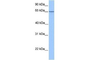 Western Blot showing PML antibody used at a concentration of 1.