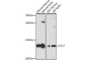 Western blot analysis of extracts of various cell lines using CKLF Polyclonal Antibody at dilution of 1:1000. (CKLF antibody)